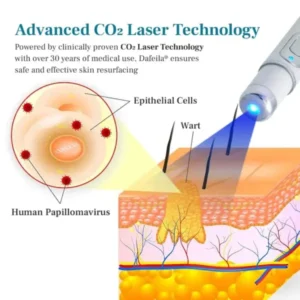 DAFEILA® LumeSkin Mole and Wart Removal Laser Pen