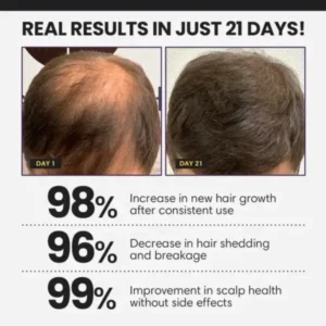 Dafeila® FollicleBoost 5X Hair Growth Serum