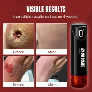 Dafeila® Glyconova Blood Sugar Inhaler