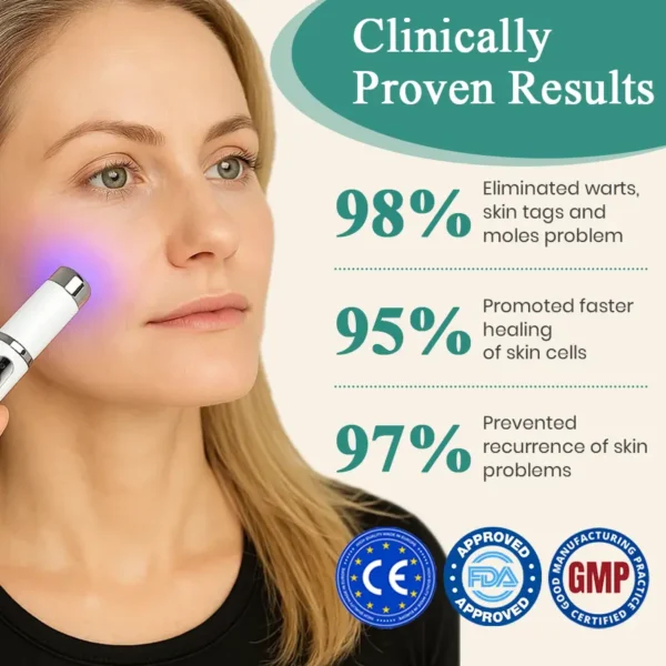 DAFEILA® LumeSkin Mole and Wart Instant Removal Laser Pen ACE