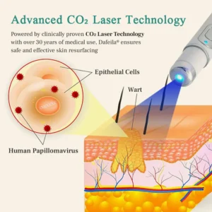DAFEILA® LumeSkin Mole and Wart Instant Removal Laser Pen ACE