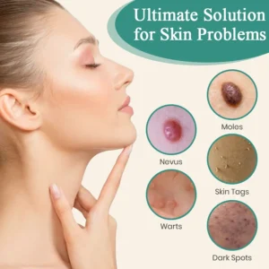 DAFEILA® LumeSkin Mole and Wart Instant Removal Laser Pen ACE