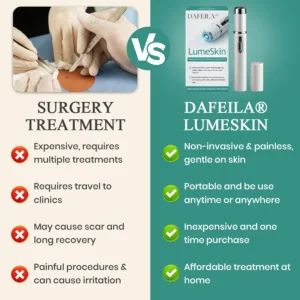 DAFEILA® LumeSkin Mole and Wart Instant Removal Laser Pen ACE