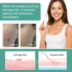 Dafeila® Advanced Plasma Laser Spot Cleaning Pen