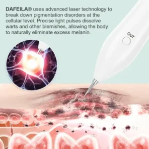 Dafeila® Advanced Plasma Laser Spot Cleaning Pen
