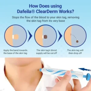 Dafeila® ClearDerm At-home Skin Tag Removal Pen