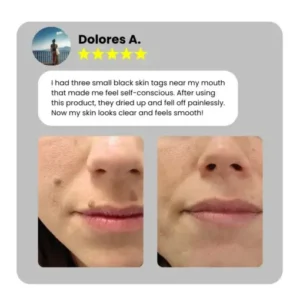 Dafeila® Shot Erase Pro