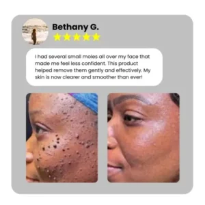 Dafeila® Shot Erase Pro