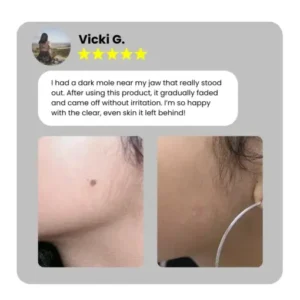 Dafeila® Shot Erase Pro