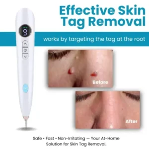 Dafeila® Shot Erase Pro