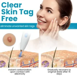 Dafeila® Shot Erase Pro