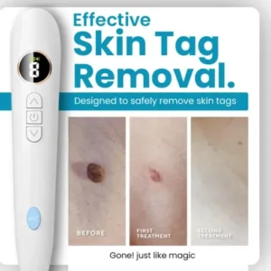 Dafeila® Shot Erase Pro