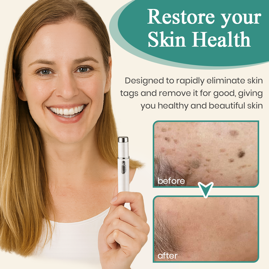 DAFEILA® LumeSkin Mole and Wart Instant Removal Laser Pen ACE 4 - Image 2