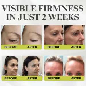 👏🌿Made and shipped from the USA 💫DAFEILA® Botox & Vita-A Retinol Shot Wrinkle-Lift Tightening cream - Last Day Promotion 70% OFF